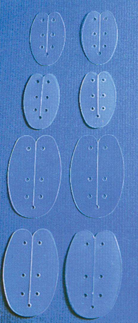 Septumschiene nach Reuter, steril